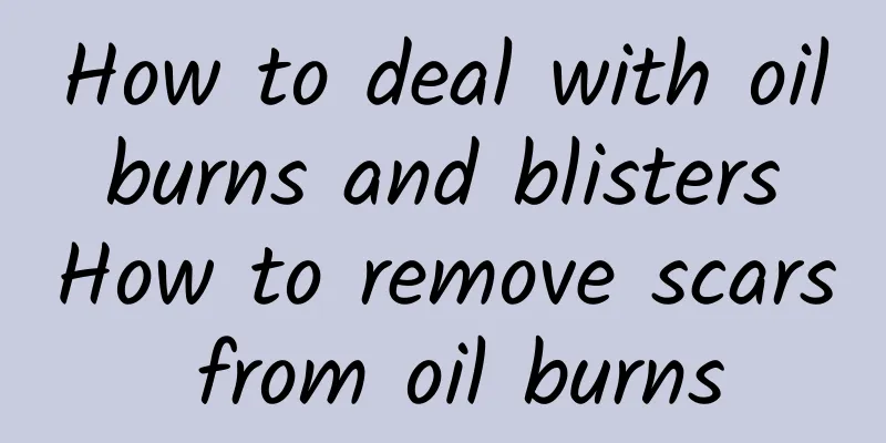 How to deal with oil burns and blisters How to remove scars from oil burns